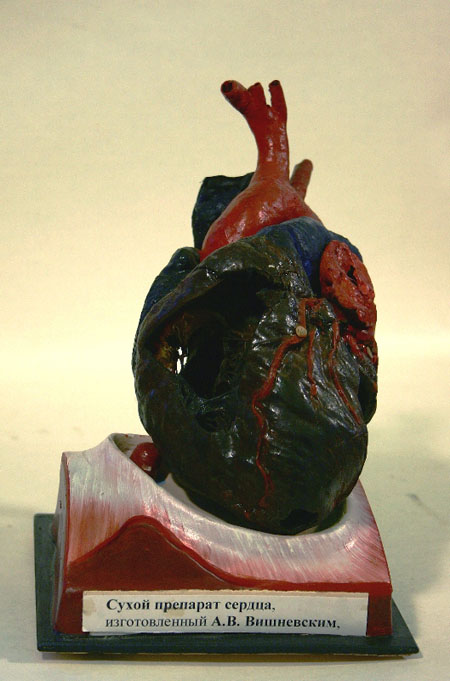 Экспозиции: Сердце человека
